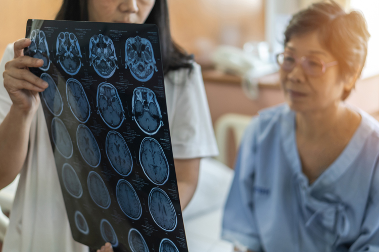 Traumatic Brain Injuries in Senior Citizens